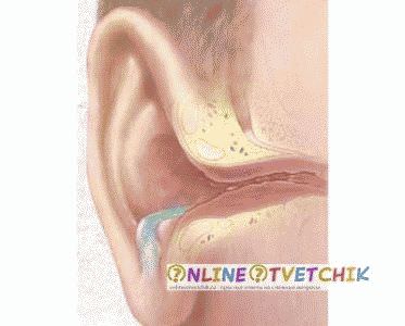 жидкость их уха