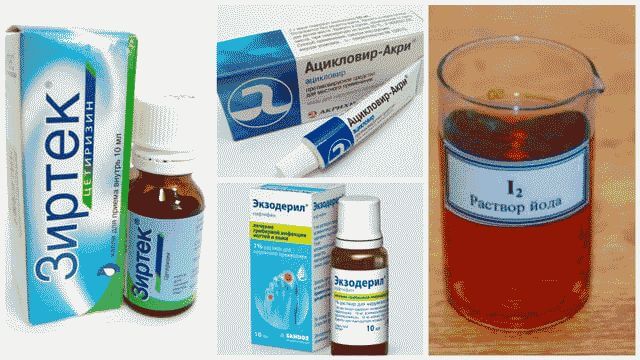 Как лечить лишай в домашних условиях?