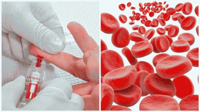 gemoglob5