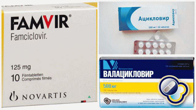 Как избавиться от герпеса на губах в домашних условиях за 1 день?