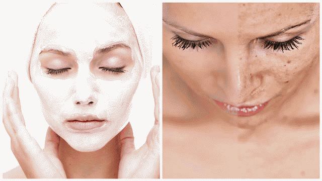 Как убрать веснушки с лица в домашних условиях?