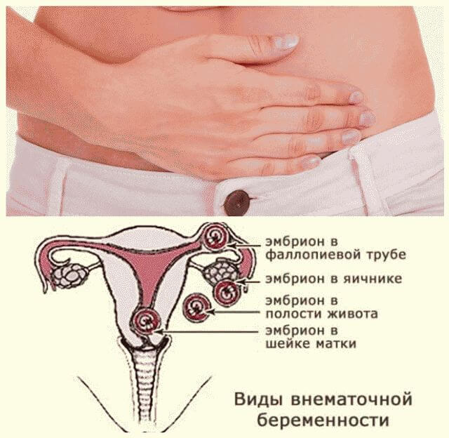 Почему болит низ живота у женщин: причины