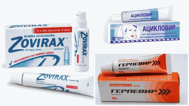 Как избавиться от герпеса на губах в домашних условиях за 1 день?