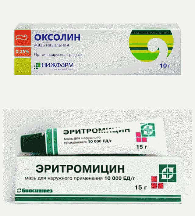 Как вылечить стоматит во рту быстро?