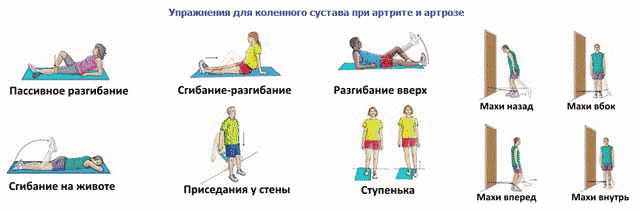 Почему болят колени и как лечить?
