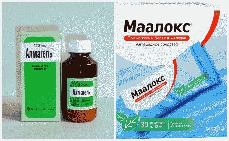 Рефлюкс-эзофагит: лечение, препараты