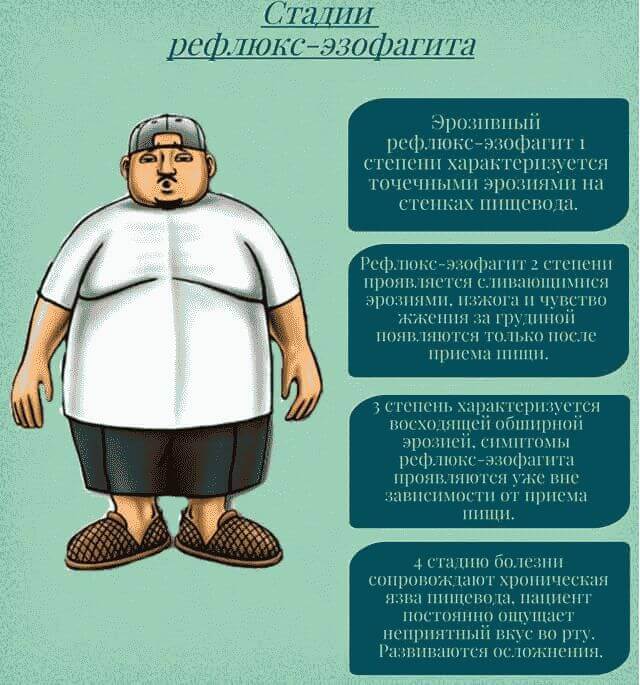 Рефлюкс-эзофагит: лечение, препараты