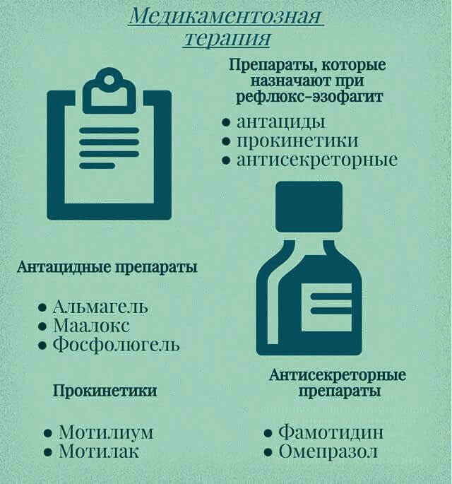 Рефлюкс-эзофагит: лечение, препараты