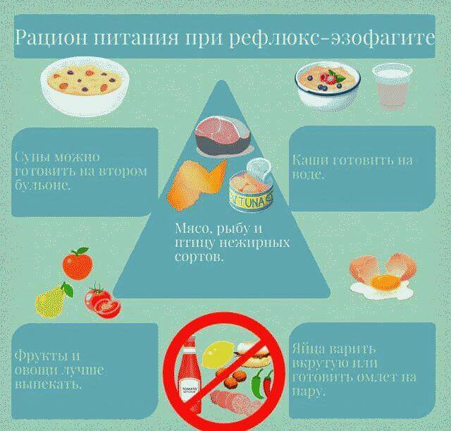 Рефлюкс-эзофагит: лечение, препараты