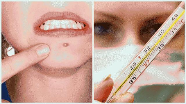 Как лечить фурункул в домашних условиях быстро?