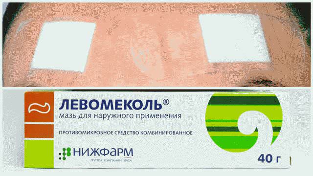 Как лечить фурункул в домашних условиях быстро?