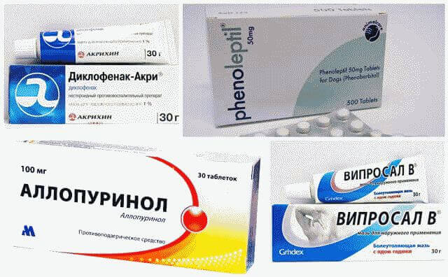 Болит нога в области стопы сверху: что делать?