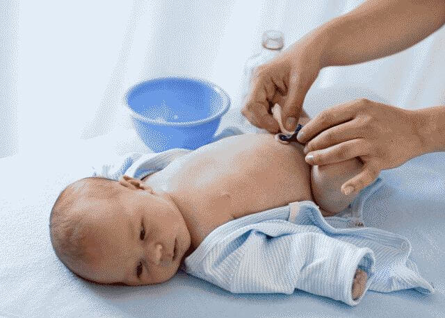 Обработка пупочной ранки у новорожденного