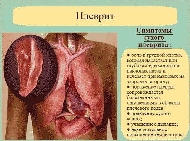 Боль в левом подреберье: что это может быть?