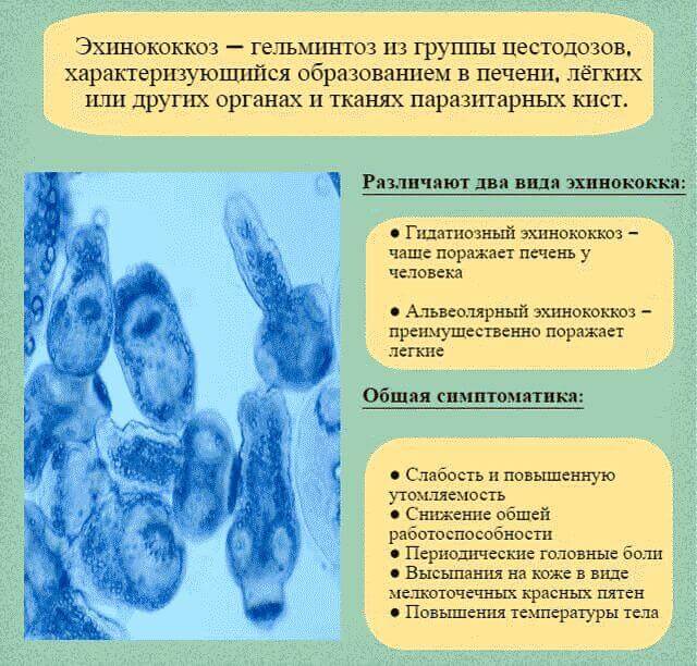 Боль в правом боку под ребрами спереди и сзади