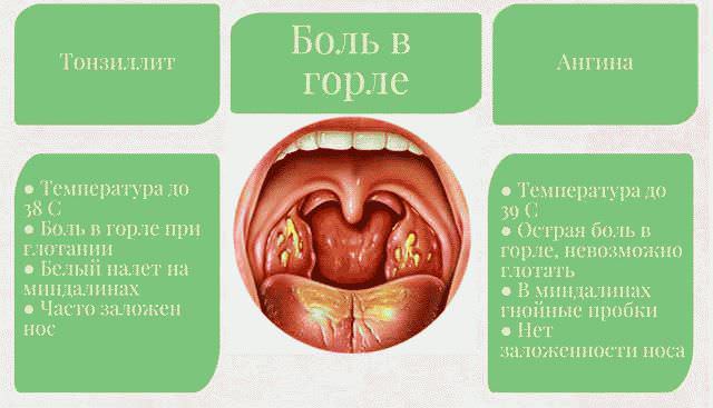 Болит горло с одной стороны при глотании